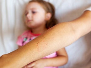 Γιατί δαγκώνει το παιδί μου